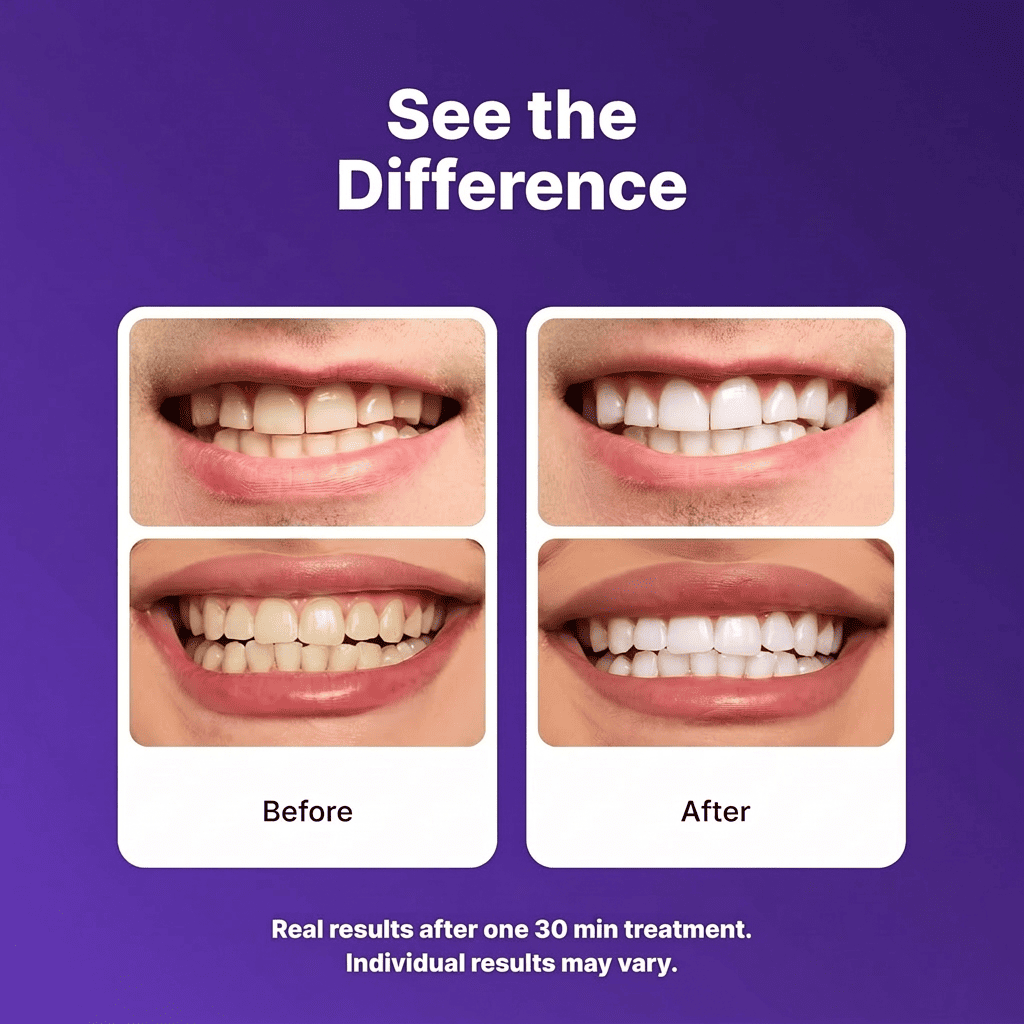 Blume Whitening Strips